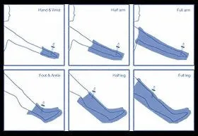 Air Splints